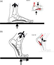 Freebody diagram of a normal foot