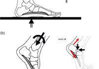 Freebody diagram of a normal foot